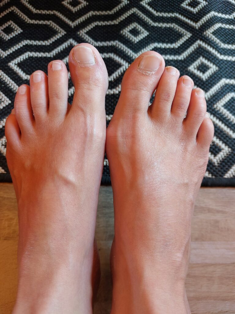 soin pieds Nureskin : mes pieds, 20 jours après le peeling.